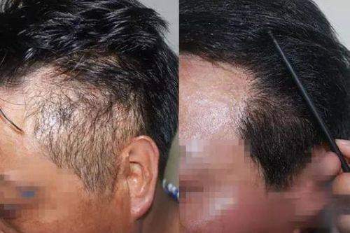 湖州心悦医疗美容门诊部收费价格表：