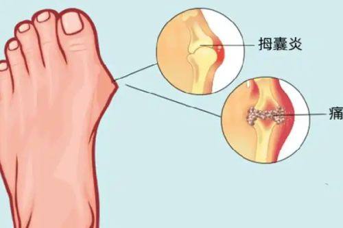 四、开水烫伤疤痕：多种方案对应不同疤痕类型