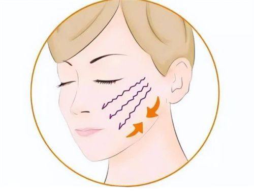 三、从术式本质看纳米双眼皮的持久差异