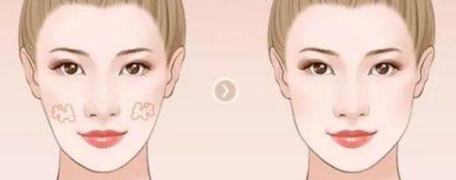 六、小孩疤痕修复的关键注意事项