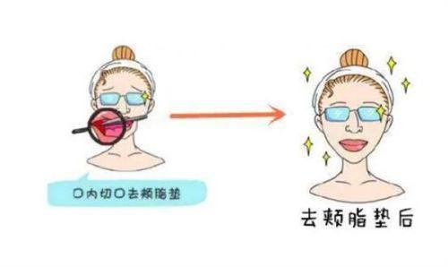 四、中重度松弛：手术方案实现持久改善