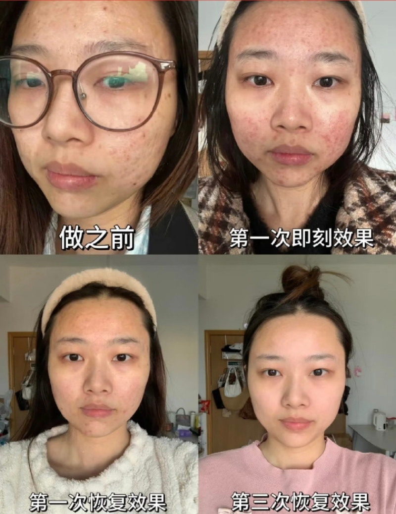 三、不正规材料与机构暗藏的后遗症