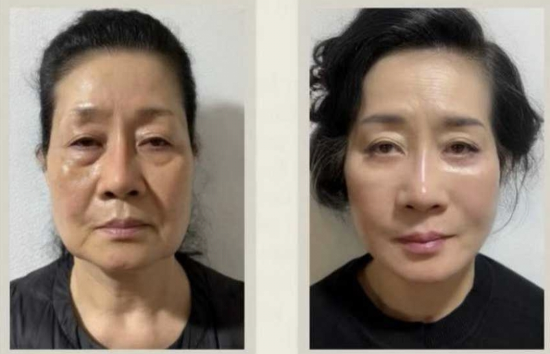 二、精细把握眼部解剖：从根源规避血管损伤