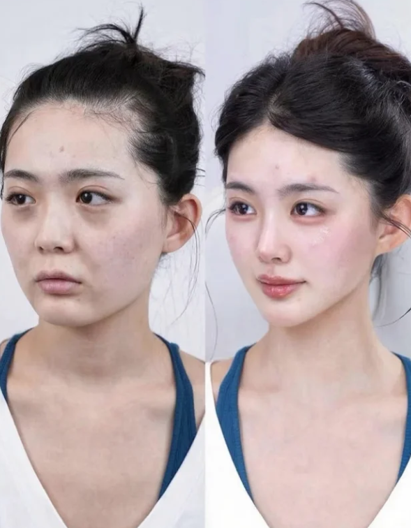 五、腿部抽脂后遗症的科学应对方法