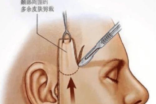 三、什么东西可以去脸上疤痕和红印