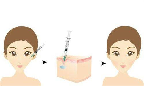 五、私人割双眼皮失败了怎么办