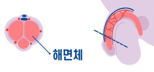 二、不手术，太阳凹陷怎样变饱满