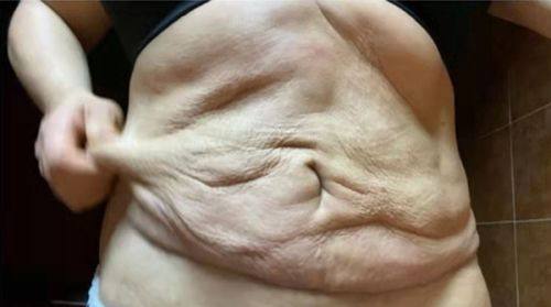 五、治疗与护理的关键避坑要点