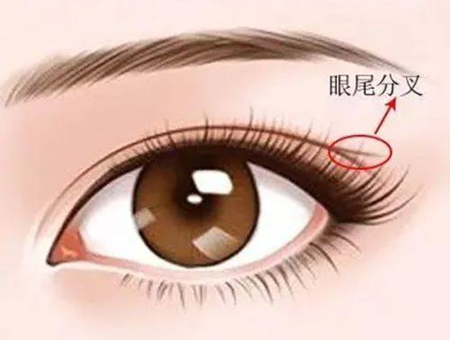 二、打了瘦脸针没感觉正常吗