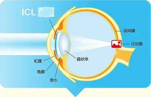 二、先辨明成效不明显的根源，再谈补打必要性