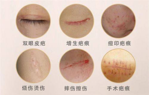 三、打完瘦脸针没有一点感觉是没成效吗