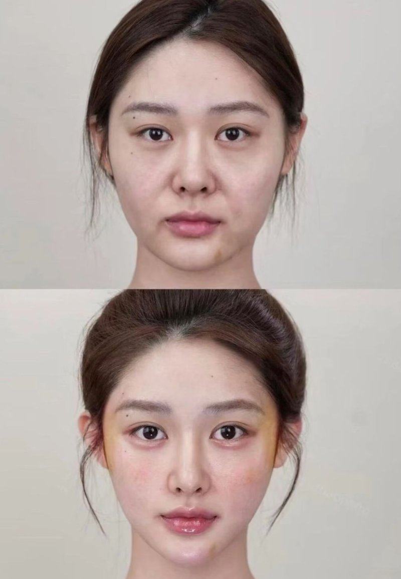 三、国内靠谱祛疤医院及医生推荐