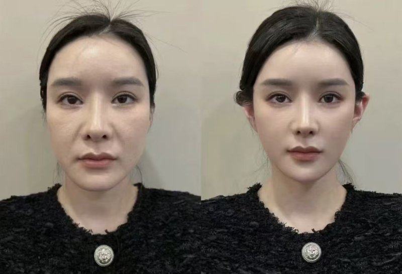 耳朵疤痕疙瘩怎么除？彻底消除方案医院及费用汇总，别等它越长越大