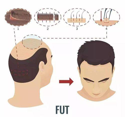 三、这些伴随症状需警惕，及时就医别拖延