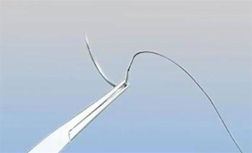 六、烫伤疤痕护理的实用小妙招