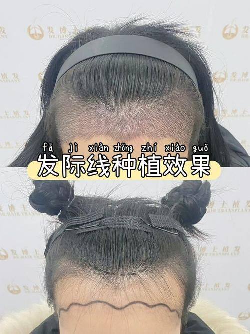 成都如悦整形医疗美容医院擅长项目：