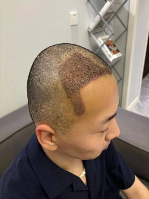 沈阳和平安加爱德医疗美容诊所擅长项目