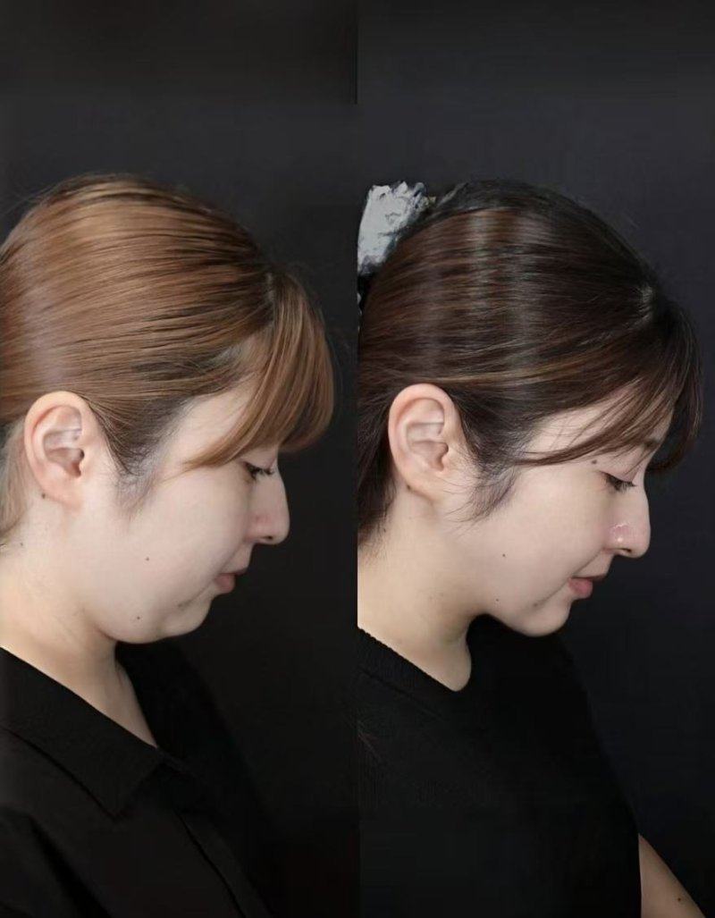 六、特殊情况：介入治疗作为补充选择