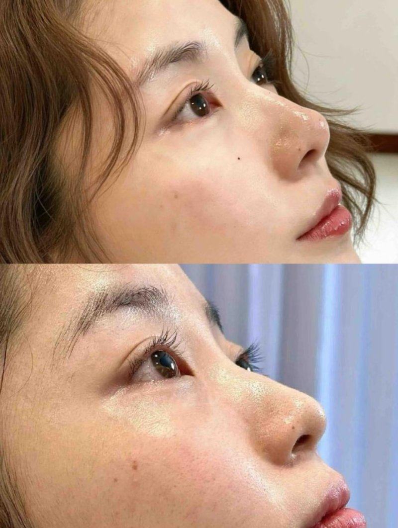 六、疤痕色素改善：个性化方案才是关键