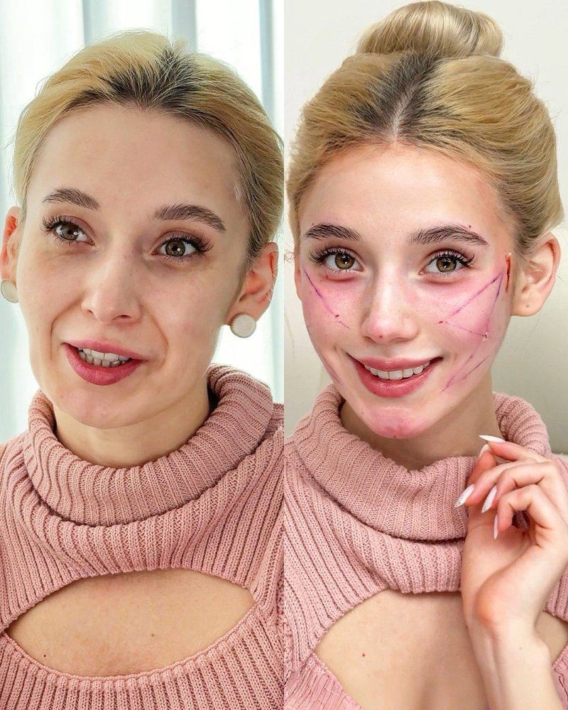 六、祛眼袋的注意事项与总结