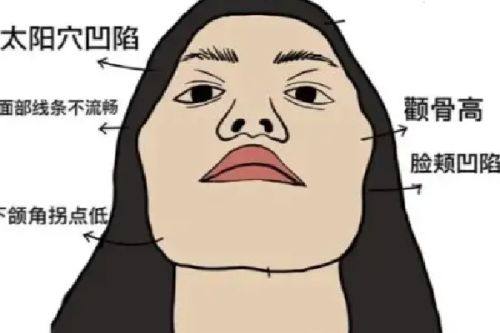 五、种睫毛前需要和医生沟通的几个要点