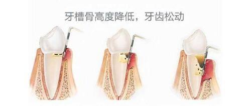 年轻人祛眼袋必避的5大误区