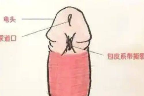 四、判断双眼皮是否修复稳定的几个关键指标