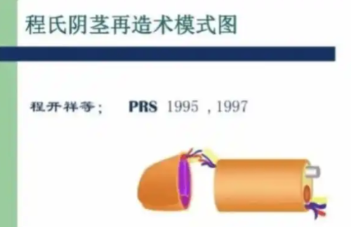 割的双眼皮可以修复吗？能复原、含费用参考、常见术后问题对应修复方案