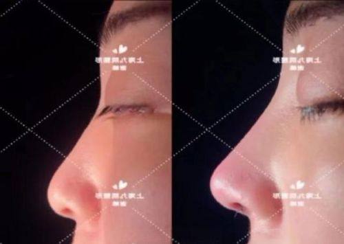 淮安华美整形医疗美容门诊部口碑评价：