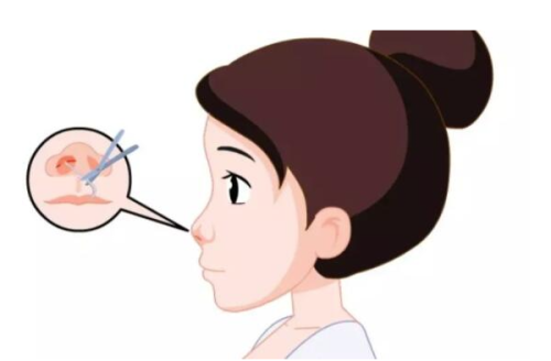 北京伊摩整形怎么样？