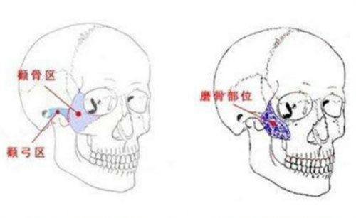 二、术后短期并发症：不可忽视的即时风险