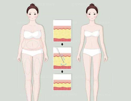 五、假体长期留存的安心准则