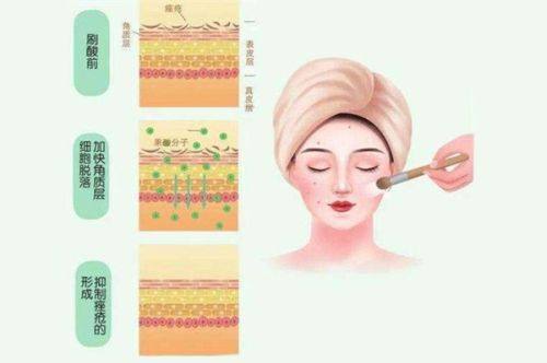 耳软骨隆鼻多长时间？手术时长、恢复周期、消肿定型及饮食时间全解析