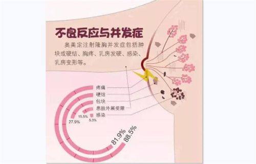 三、影响假体终身留存的关键因素