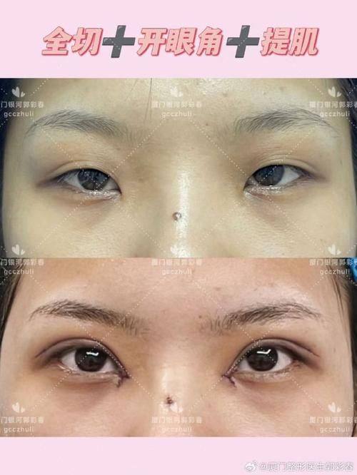 北京伊摩整形价格表：