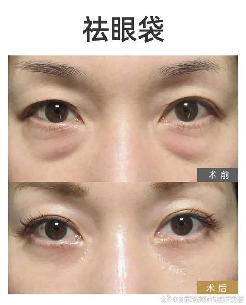 北京伊摩整形医生名单及擅长领域：