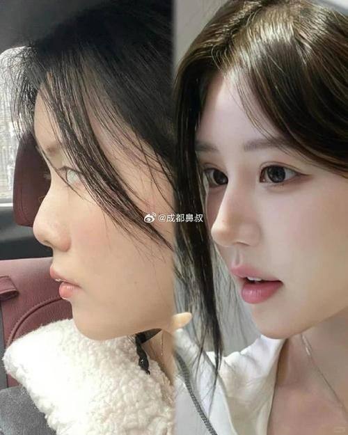 北京知音蕊丽医疗美容门诊部擅长项目：