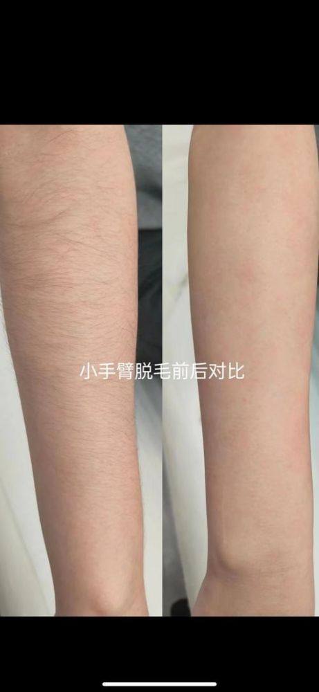 淮安华美整形医疗美容门诊部怎么样？