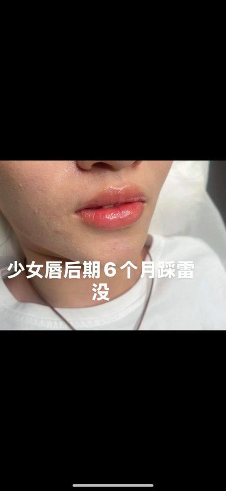 韩国崔寓植Noselips整形外科地址电话及营业时间