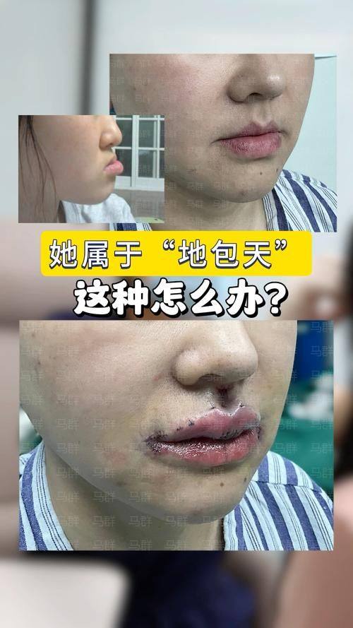 临沂V整形美容医院医生名单及擅长领域：