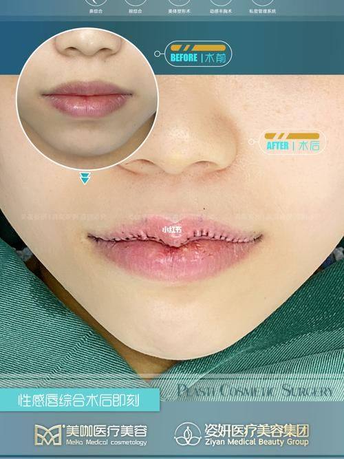 临沂V整形美容医院怎么样？