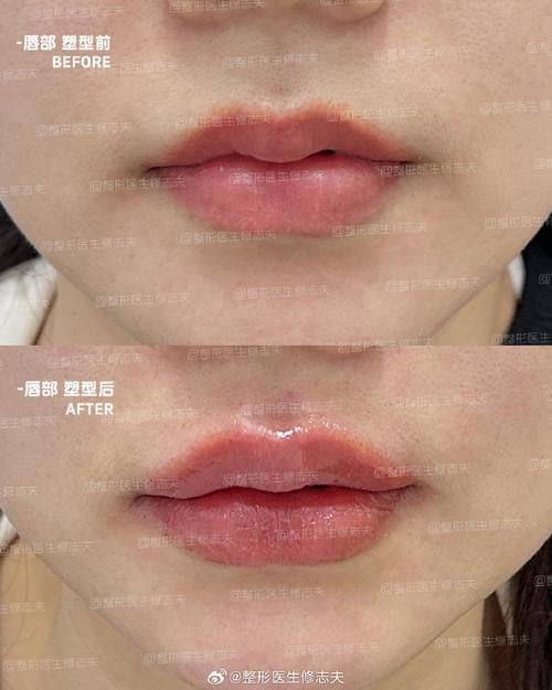 临沂V整形美容医院口碑评价