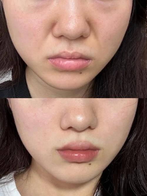 长沙瑞澜医美医院怎么样？