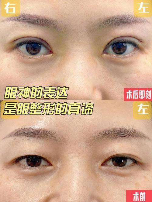 湘西韩影医疗美容诊所价格表：