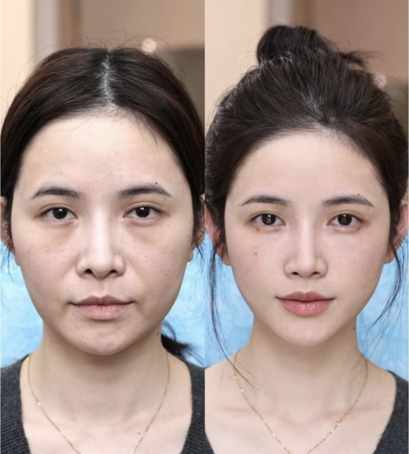 二、常见术后问题的对应修复方案