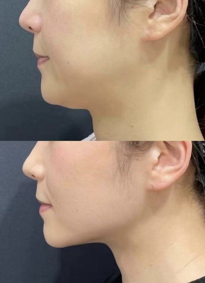 北京知音蕊丽医疗美容门诊部口碑评价