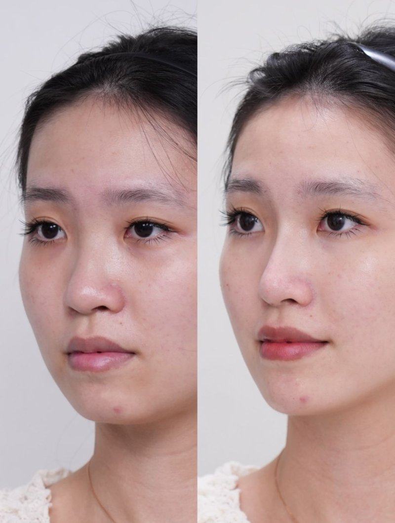 北京知音蕊丽医疗美容门诊部价格表