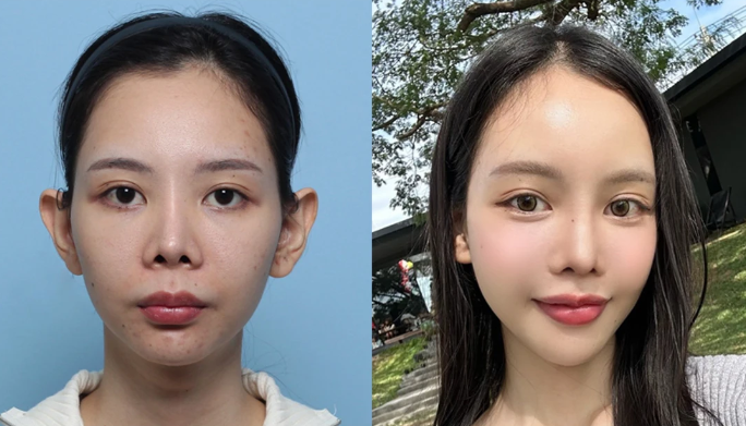 杭州东方整形美容门诊部怎么样？