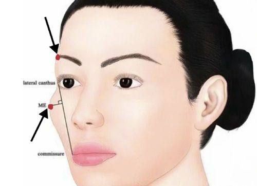 二、怎么才除去了眼袋和皱纹