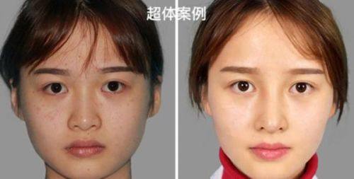 深圳盛美佳门诊部美容科价格表